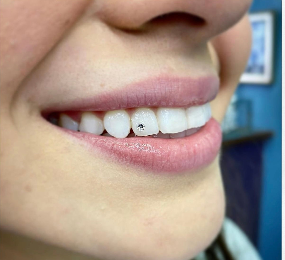Tooth Bling Application